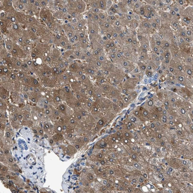 CDRT4 Antibody in Immunohistochemistry (Paraffin) (IHC (P))