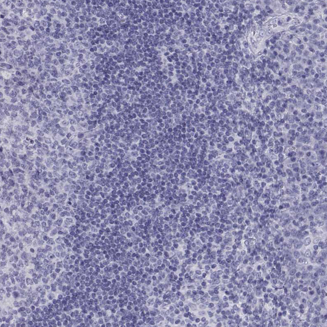 Actin-like 7A Antibody in Immunohistochemistry (Paraffin) (IHC (P))