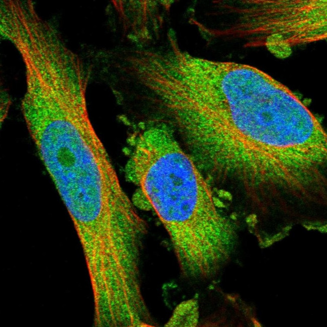 PHLP Antibody in Immunocytochemistry (ICC/IF)
