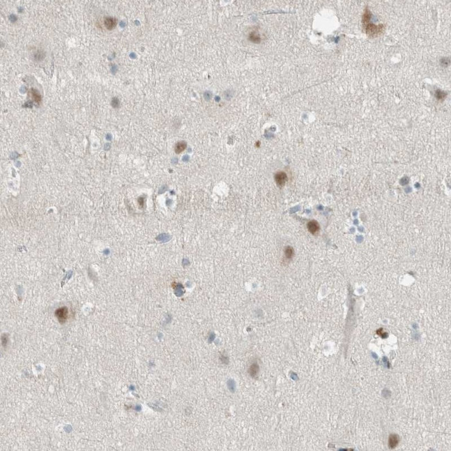 CERCAM Antibody in Immunohistochemistry (Paraffin) (IHC (P))
