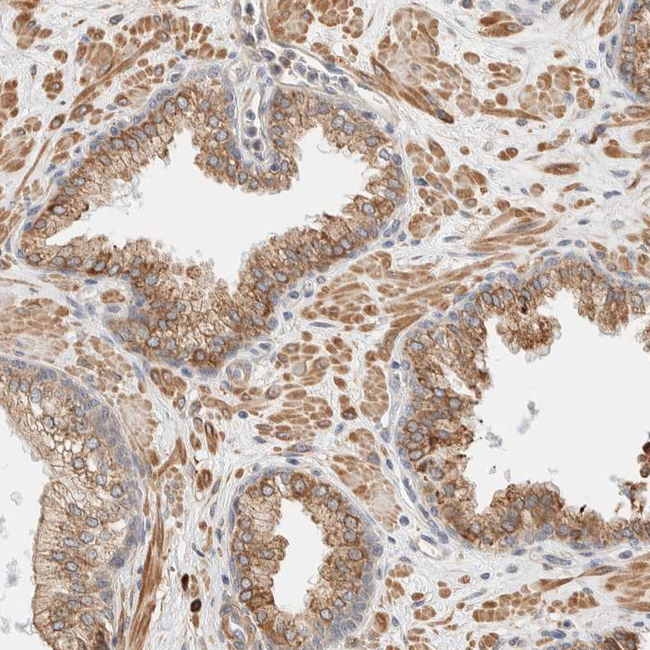 INTS1 Antibody in Immunohistochemistry (Paraffin) (IHC (P))