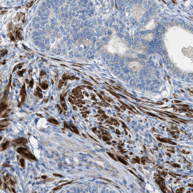 AOAH Antibody in Immunohistochemistry (Paraffin) (IHC (P))