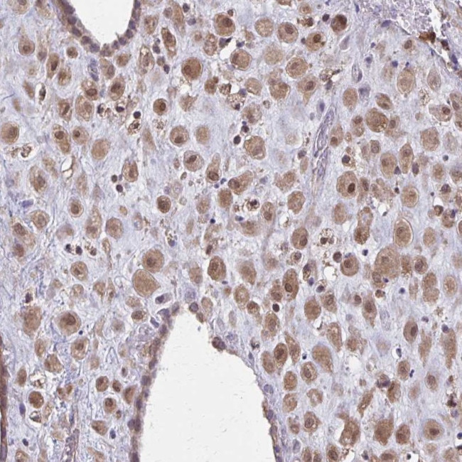 NRBF2 Antibody in Immunohistochemistry (Paraffin) (IHC (P))