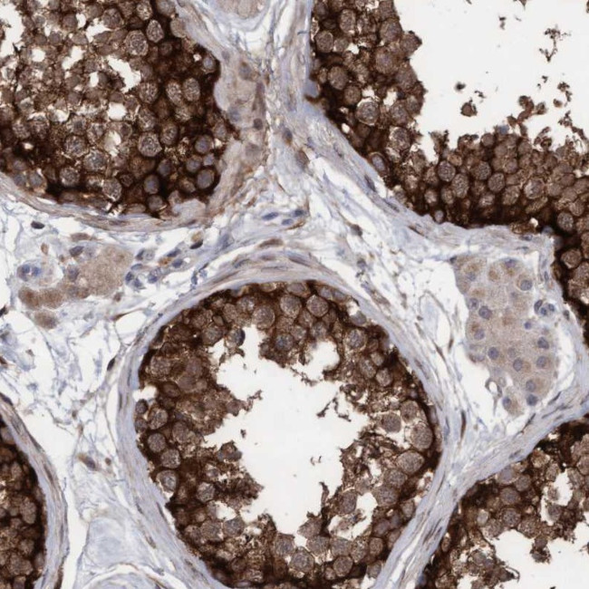 PLCD1 Antibody in Immunohistochemistry (Paraffin) (IHC (P))
