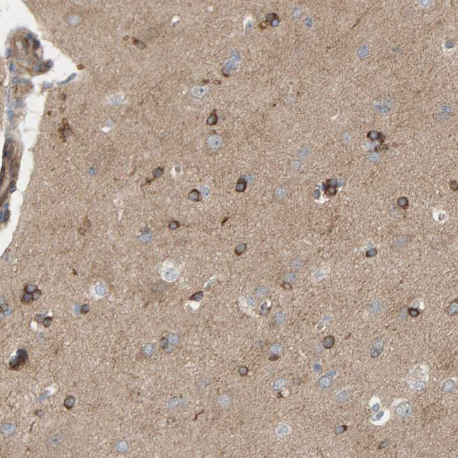 PDE1C Antibody in Immunohistochemistry (Paraffin) (IHC (P))