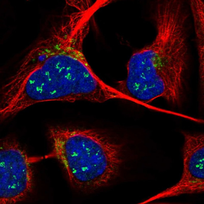 ANKRD40 Antibody in Immunocytochemistry (ICC/IF)