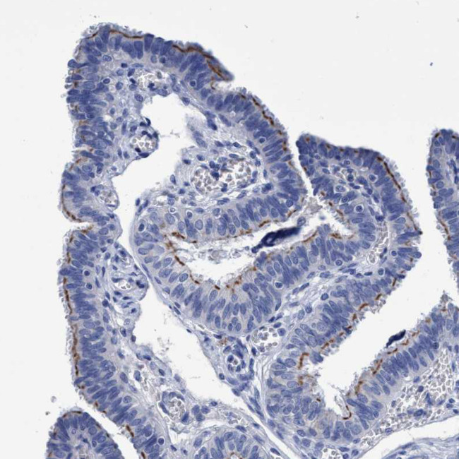 CROCC Antibody in Immunohistochemistry (Paraffin) (IHC (P))