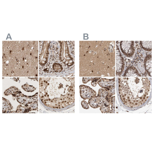 CBLL1 Antibody in Immunohistochemistry (IHC)