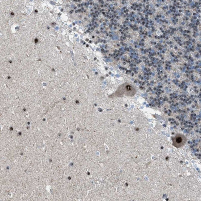 CENPP Antibody in Immunohistochemistry (IHC)