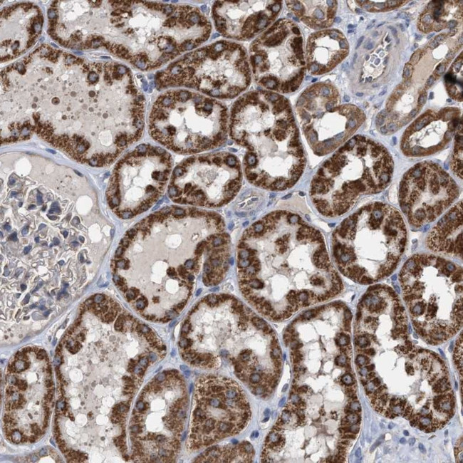 RRP4 Antibody in Immunohistochemistry (Paraffin) (IHC (P))