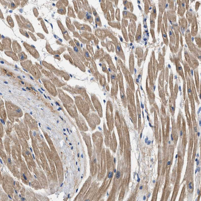 MYH3 Antibody in Immunohistochemistry (IHC)