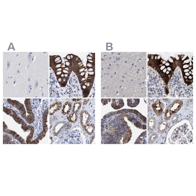MKS1 Antibody in Immunohistochemistry (IHC)