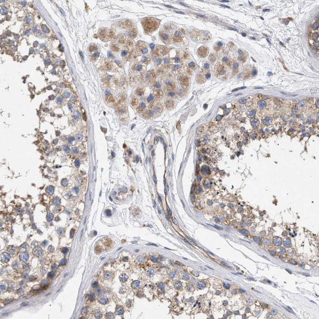 MAMDC2 Antibody in Immunohistochemistry (Paraffin) (IHC (P))