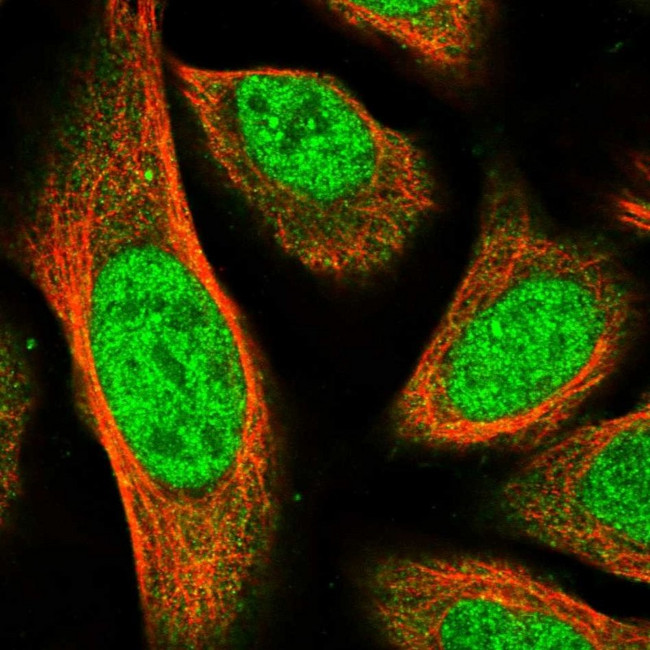 MPP3 Antibody in Immunocytochemistry (ICC/IF)
