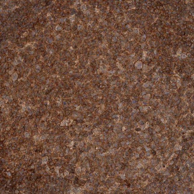 RNF157 Antibody in Immunohistochemistry (Paraffin) (IHC (P))