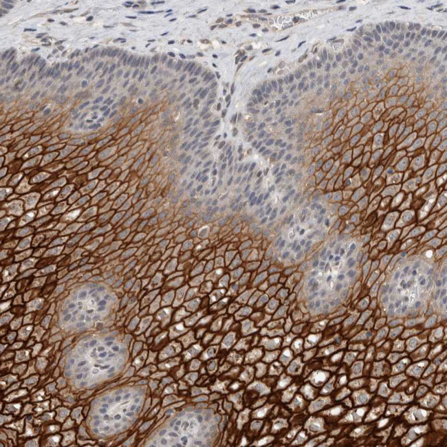 CYSRT1 Antibody in Immunohistochemistry (Paraffin) (IHC (P))