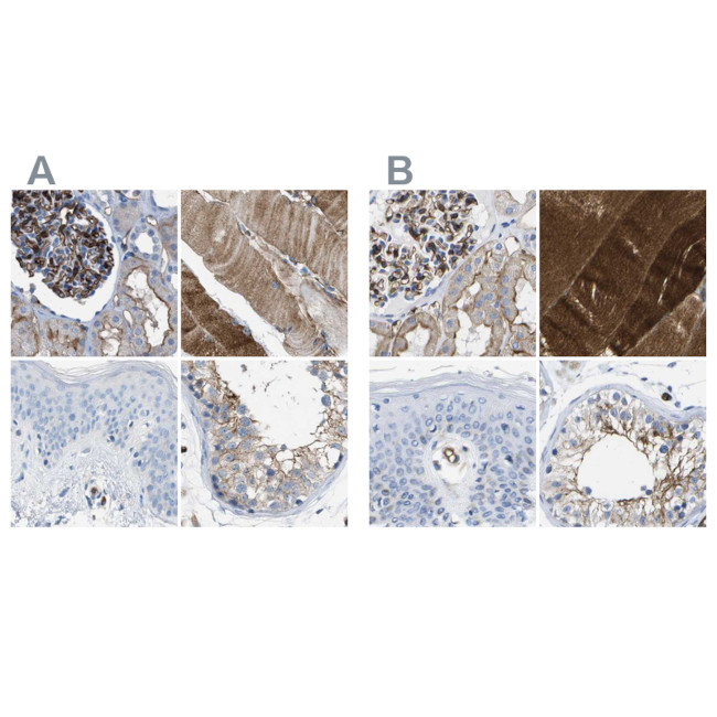 Dysferlin Antibody in Immunohistochemistry (IHC)