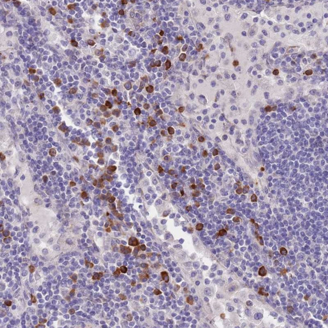 TNRC6C Antibody in Immunohistochemistry (Paraffin) (IHC (P))