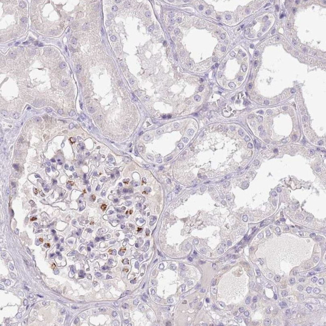 MRO Antibody in Immunohistochemistry (IHC)