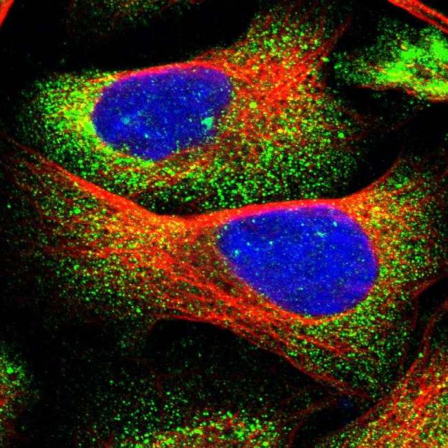 CDR2L Antibody in Immunocytochemistry (ICC/IF)
