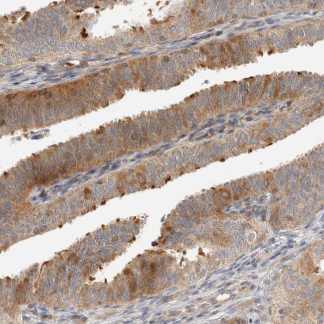 KIF9 Antibody in Immunohistochemistry (Paraffin) (IHC (P))