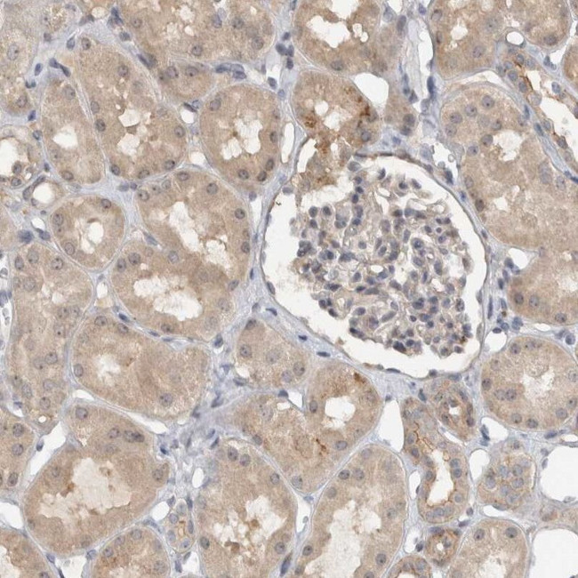 MPRIP Antibody in Immunohistochemistry (IHC)