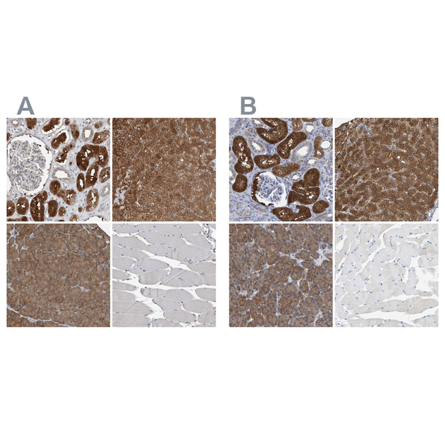 ALAD Antibody in Immunohistochemistry (Paraffin) (IHC (P))