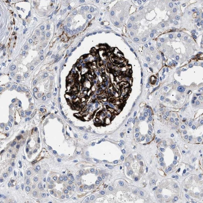 OLFML2A Antibody in Immunohistochemistry (IHC)