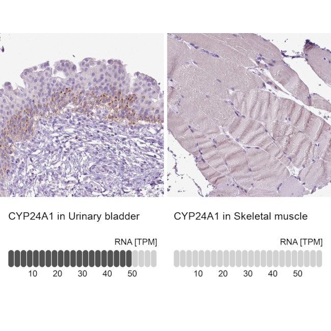CYP24A1 Antibody in Immunohistochemistry (IHC)