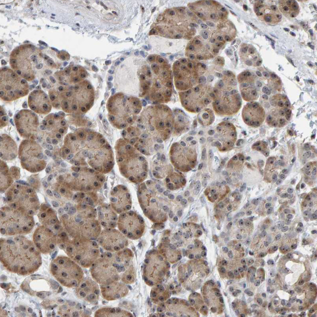 POLR1E Antibody in Immunohistochemistry (Paraffin) (IHC (P))