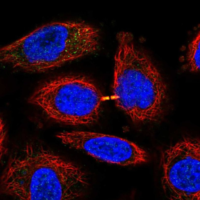 SLN13 Antibody in Immunocytochemistry (ICC/IF)