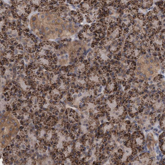 TSTD2 Antibody in Immunohistochemistry (Paraffin) (IHC (P))