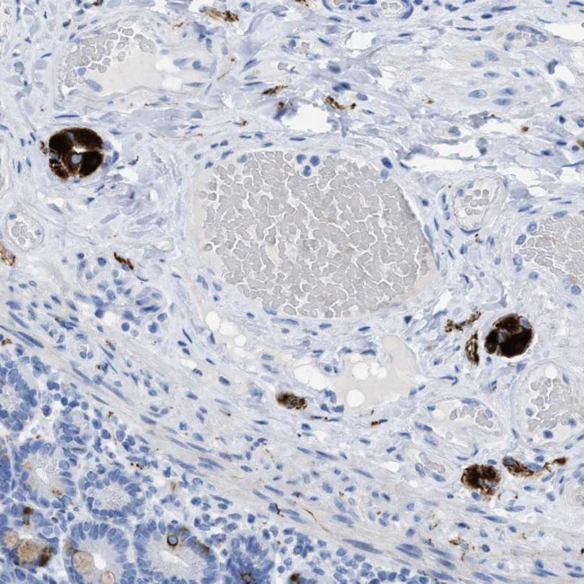 ANKFN1 Antibody in Immunohistochemistry (Paraffin) (IHC (P))