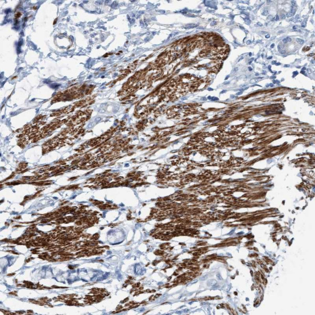 FAM187A Antibody in Immunohistochemistry (Paraffin) (IHC (P))