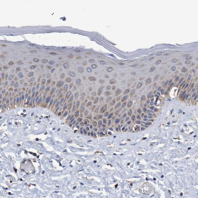 BZW2 Antibody in Immunohistochemistry (Paraffin) (IHC (P))