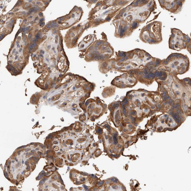 MRCK beta Antibody in Immunohistochemistry (IHC)