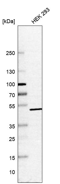 HEXDC Antibody in Western Blot (WB)