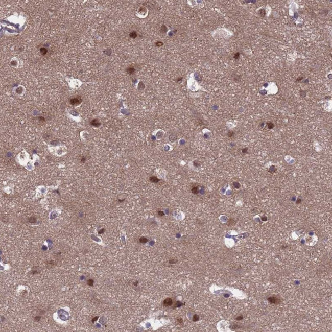 TTC35 Antibody in Immunohistochemistry (Paraffin) (IHC (P))