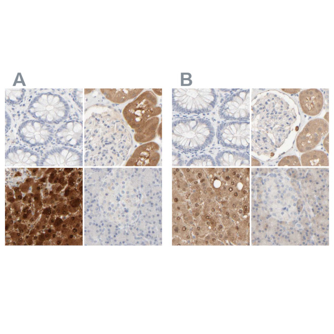 HRSP12 Antibody in Immunohistochemistry (IHC)