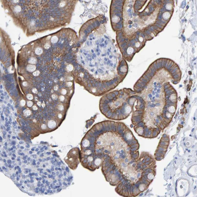 JAKMIP3 Antibody in Immunohistochemistry (Paraffin) (IHC (P))