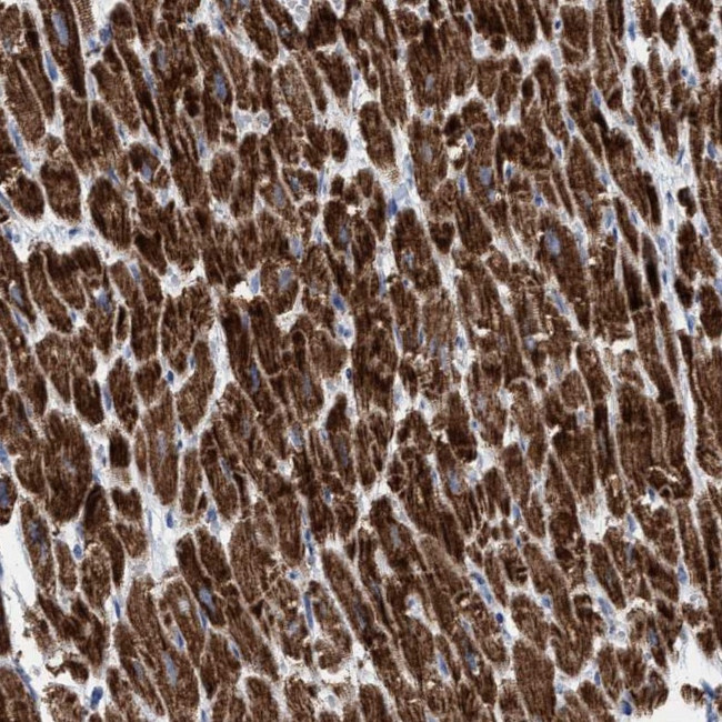 GGA3 Antibody in Immunohistochemistry (Paraffin) (IHC (P))