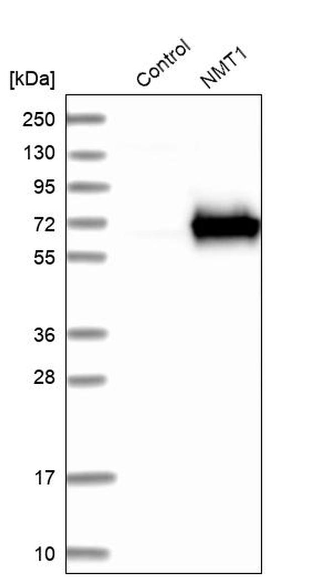 NMT1 Antibody in Western Blot (WB)