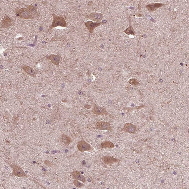 RIPX Antibody in Immunohistochemistry (IHC)