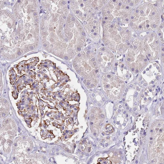 TSGA13 Antibody in Immunohistochemistry (Paraffin) (IHC (P))