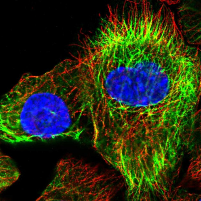 KRT24 Antibody in Immunocytochemistry (ICC/IF)