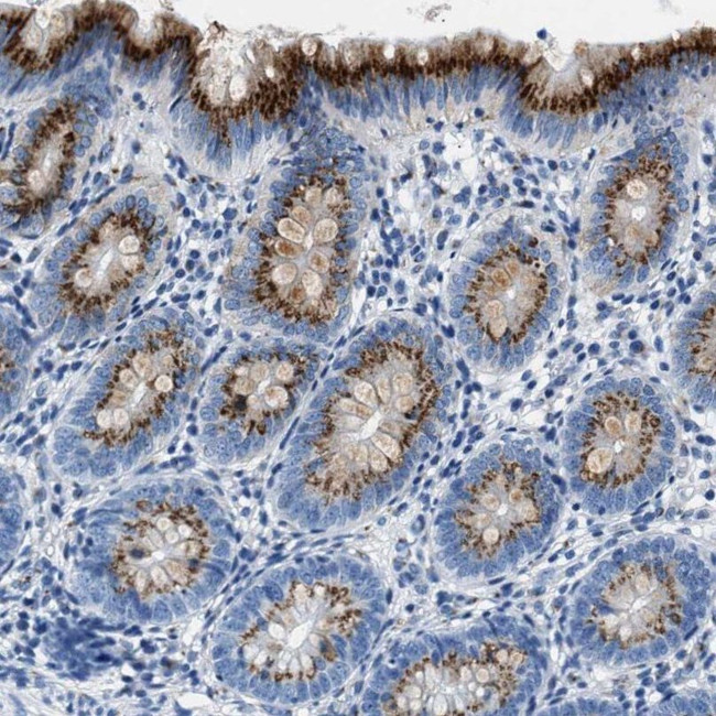 VPS53 Antibody in Immunohistochemistry (IHC)