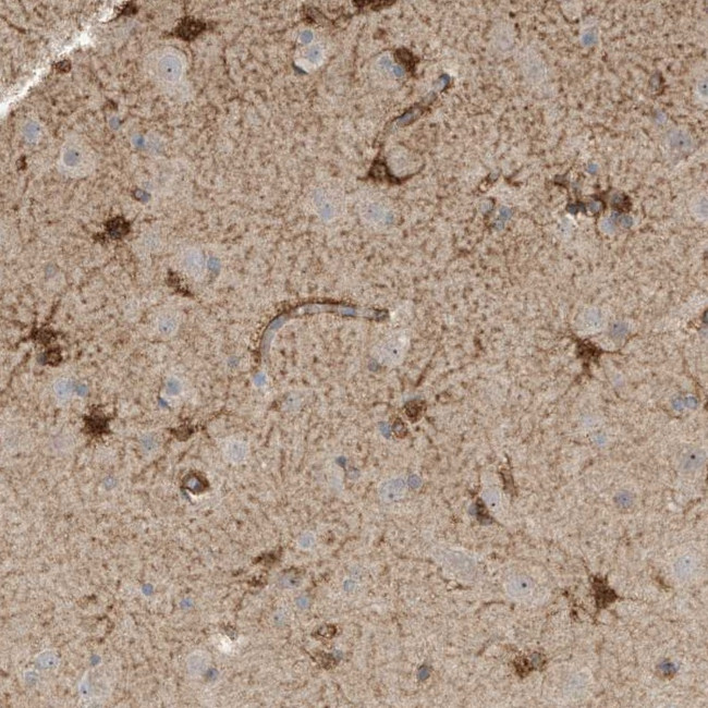 SLFN14 Antibody in Immunohistochemistry (Paraffin) (IHC (P))