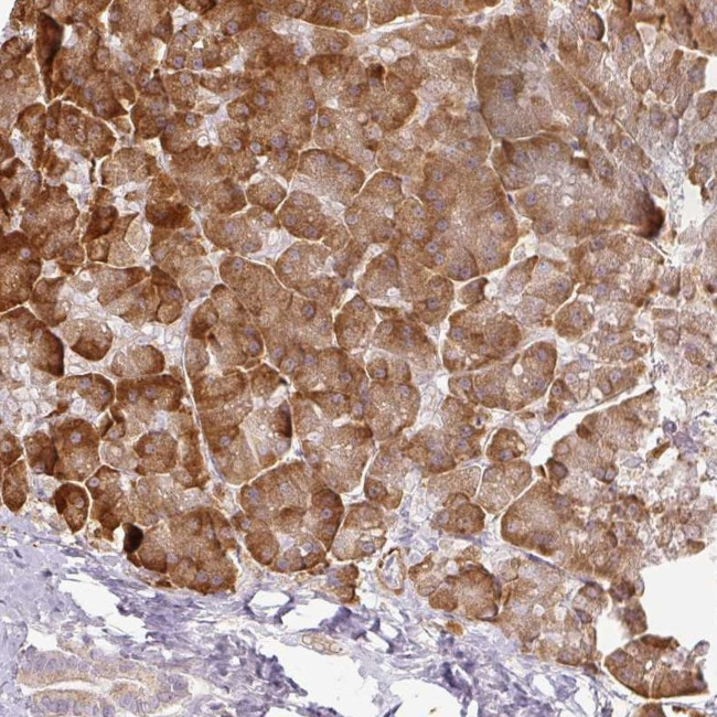 CCDC144A Antibody in Immunohistochemistry (IHC)