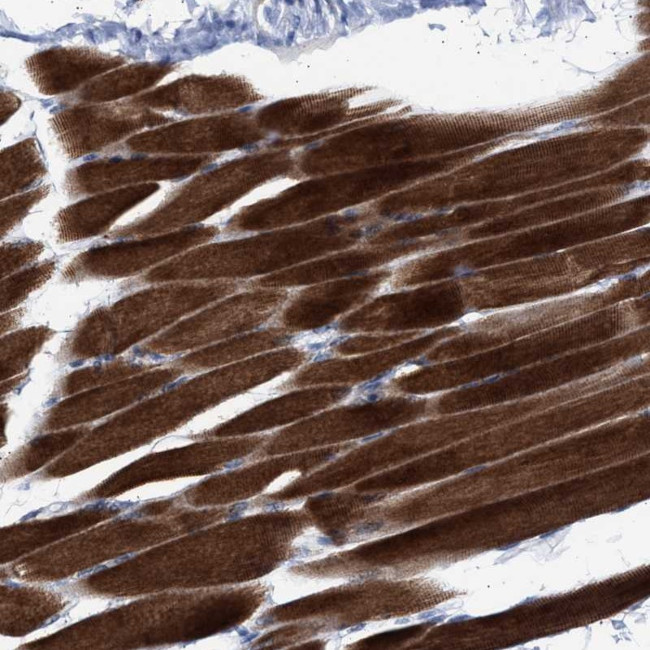 NBR1 Antibody in Immunohistochemistry (Paraffin) (IHC (P))