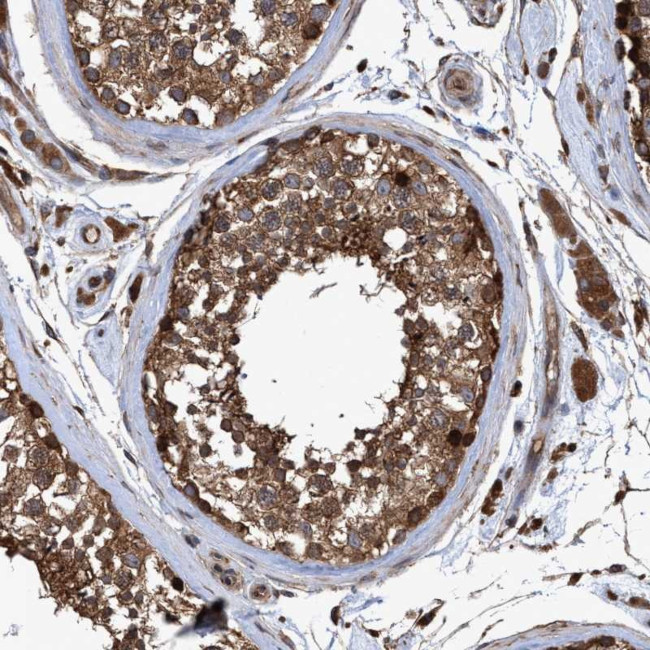 CHMP6 Antibody in Immunohistochemistry (Paraffin) (IHC (P))